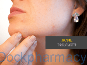 acne solution treatment