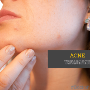 Acne Solutions
