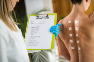 skin allergy tests